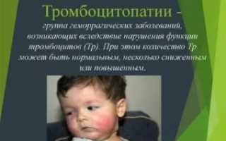 Тромбоцитопатия у ребенка