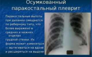 Локальное утолщение паракостальной плевры слева