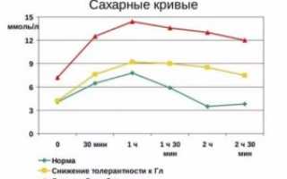 Сахарная кривая в беременность