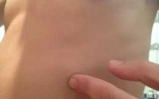 Уплотнение в области ребер