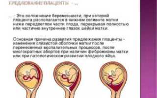 Может ли плацента опуститься