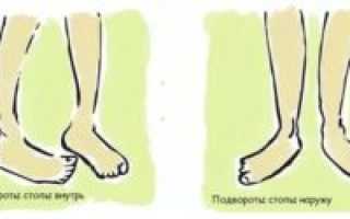 При ходьбе правая нога вывернула наружу