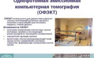 Срок годности снимка Кт