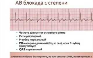 АВ блокада 1 степени