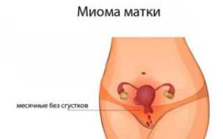 Менструация без сгустков
