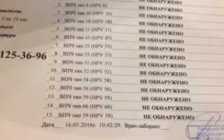 Анализ впч днк не обнаружена
