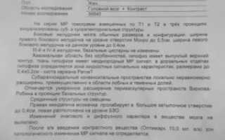 Расшифровка диагноза после МРТ