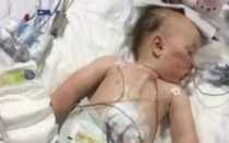 Ребенок проглотил часть сигареты