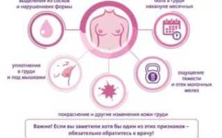 Сильно болит грудь при месячных