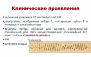 Удлинение QT интервала на Холтере