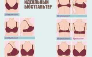 Грудь неправильной формы