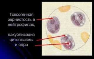 Токсогенная зернистость в крови