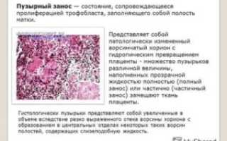 Очаговая пролиферациям трофобласта