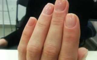 Зуд и воспаление кутикулы рук
