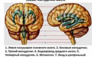 3й желудочек мозга меньше нормы