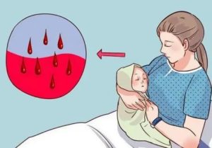 Кровянистые выделения во время грудного вскармливания