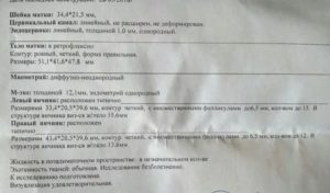 Овуляция. Жидкость в позадиматочном пространстве