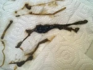 Скудные коричневые выделения один день