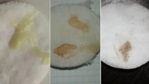 Мажущие выделения при приеме Логеста