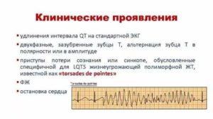 Удлинение QT интервала на Холтере