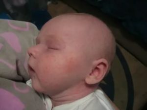 Аллергия у грудного ребенка, чешет лоб, лицо и грудь