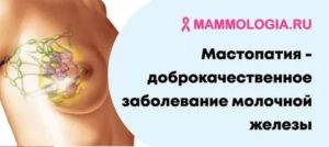 Увеличен лимфоузел при фиброаденома и мастопатии
