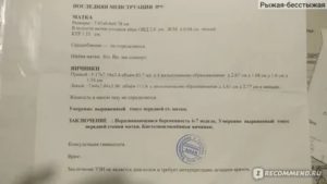 Расшифровка узи после замершей беременности