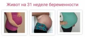 Здравствуйте! У меня 20 неделя беременности и 3день живот в тонусе