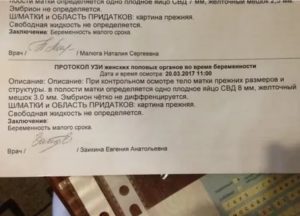 Расшифровка узи после замершей беременности