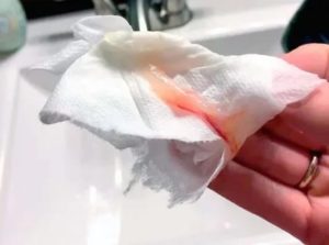 Розоватые выделения после месячных