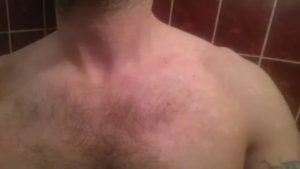 Красные точки на шее и груди