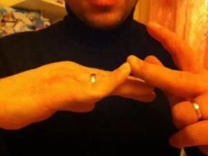 Палец гнется в другую сторону
