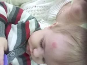Ребенок упал с дивана и ударился головой
