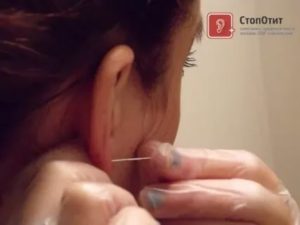 Беспокоят ушки после Долфина