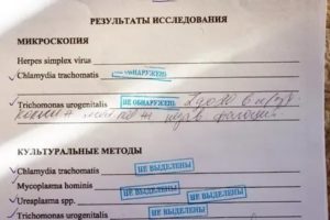 Повторный анализ ПЦР на хламидии