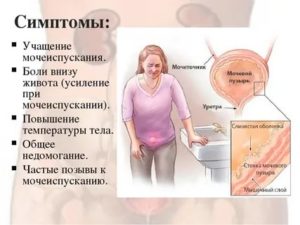 Постоянно хочется писать, дискомфорт в низу живота