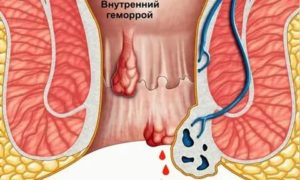 Шишка между аналом и переднем проходе