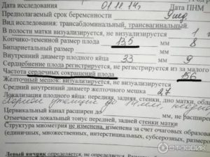 Расшифровка узи после замершей беременности