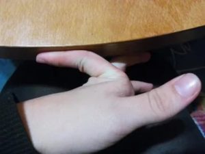 Палец гнется в другую сторону
