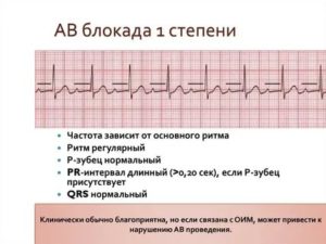 АВ блокада 1 степени