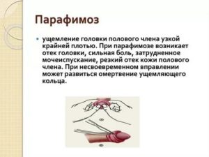 У ребенка не полностью открыта головка полового члена