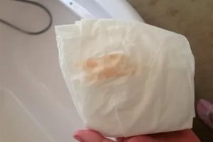 Розоватые выделения после месячных