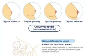 Сильно болит грудь при месячных