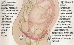 Не могу понять что болит - матка или мочевой пузырь?