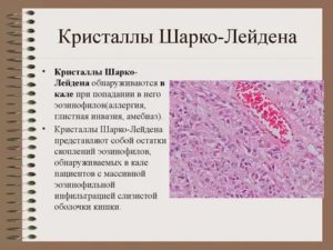 Кристалические образования Шарко-Лейдена