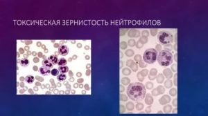 Токсогенная зернистость в крови