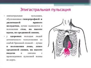 Сердце пульсирует в желудке