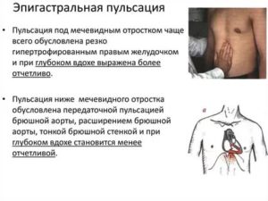 Сердце пульсирует в желудке