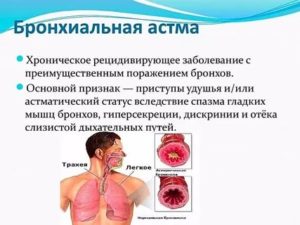 Отличить астму от невроза