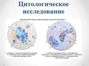 Цитологическое исследование. Помогите